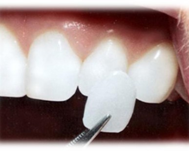 Imagenes de Galería de Conceptos Dentales