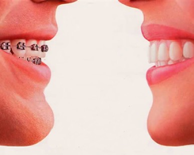 Imagenes de Galería de Conceptos Dentales
